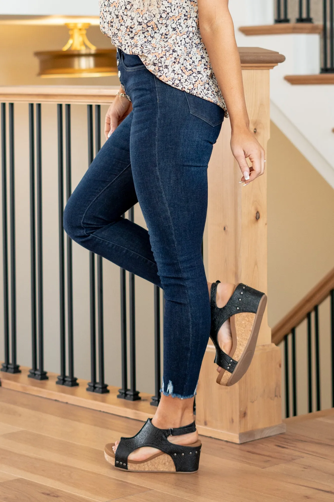 James Exposed Button Fly High Rise Ankle Skinny